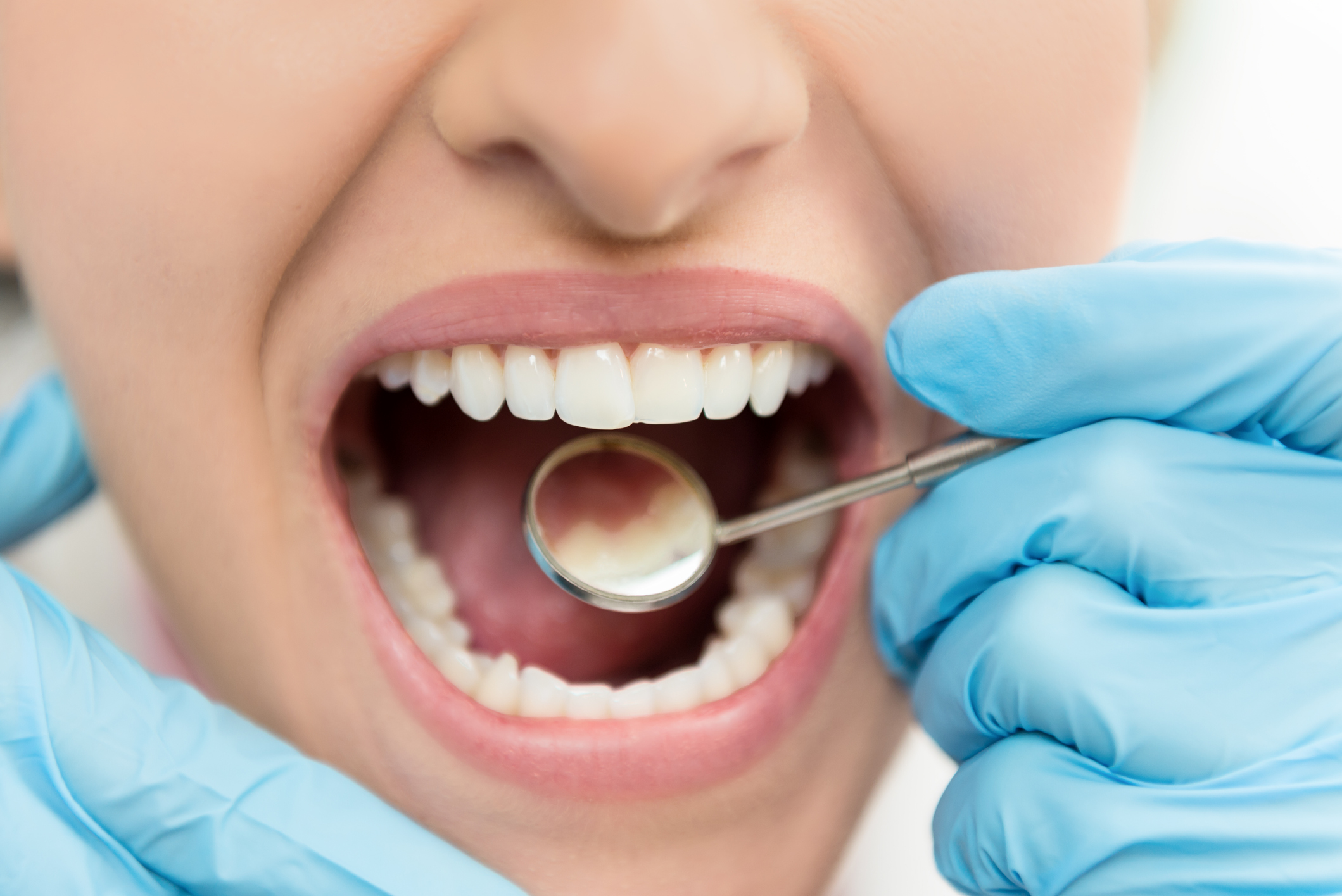 Dental Crown Treatment
