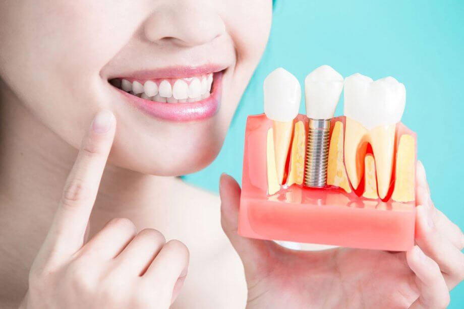 Natural tooth
